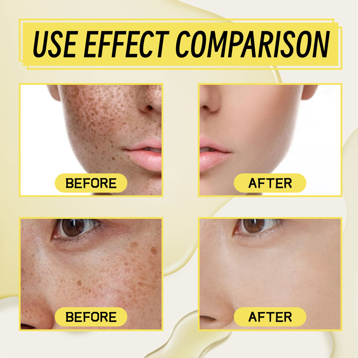 OUHOE Dark Spot Correcting Serum for Brightening Skin